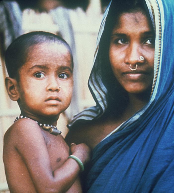 A color photograph from 1975 shows Rahima Banu as a toddler, being held by her mother. Healed smallpox scars are faintly visible on Banu鈥檚 skin. Both she and her mother look toward the camera.
